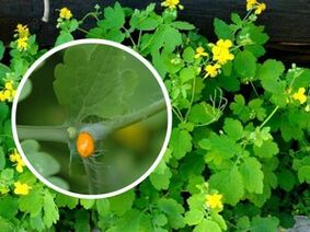 Chelidonium Herb Juice for Plantar Wart Treatment
